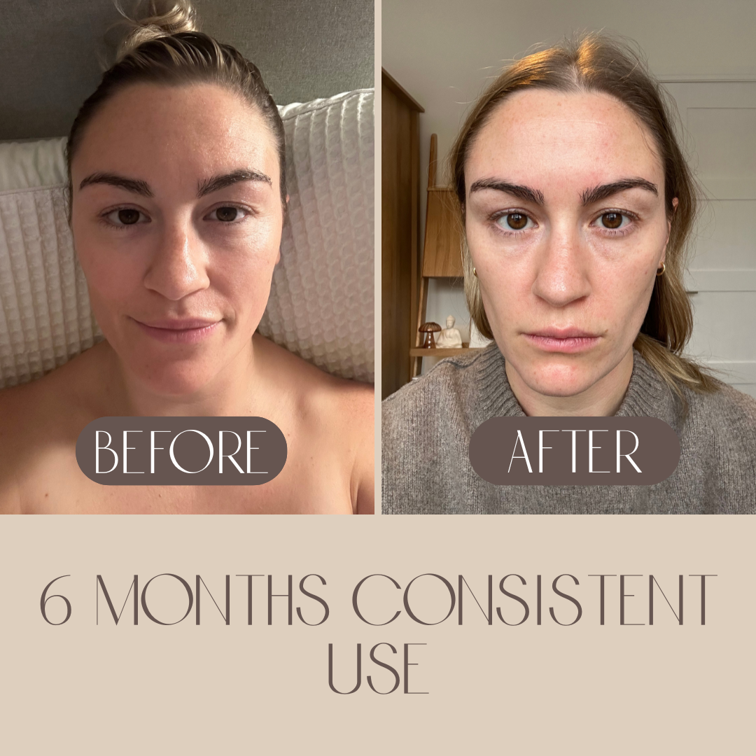 Bian Stone Facial Gua Sha