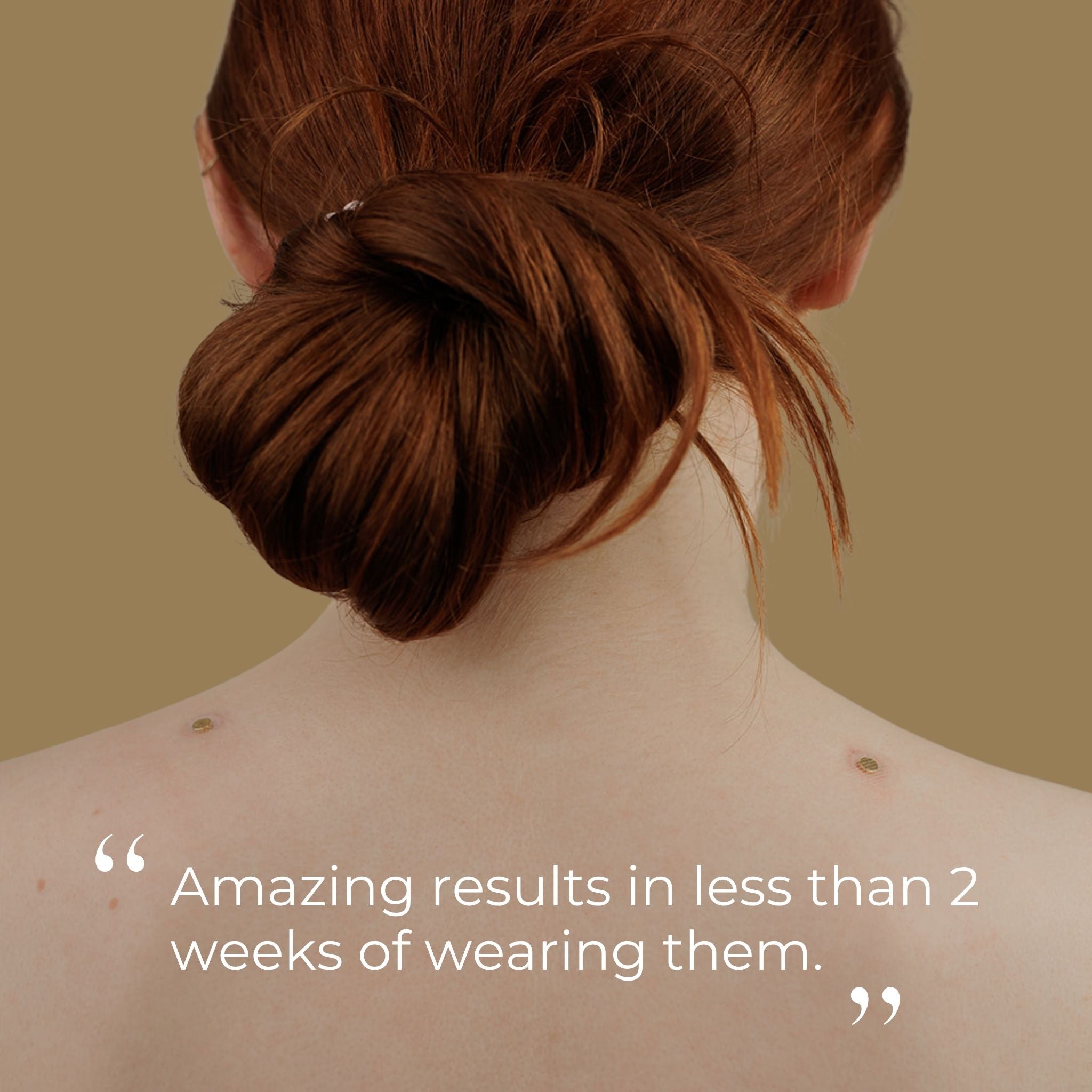 Gold Acupressure Magnet Patches